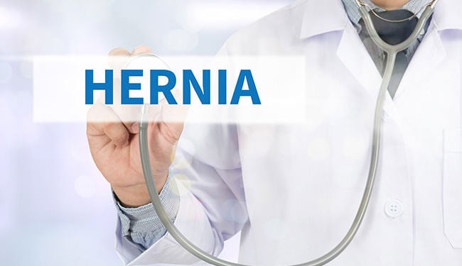 Hernia-Repair-Weight-Loss-Surgery-Institute-1