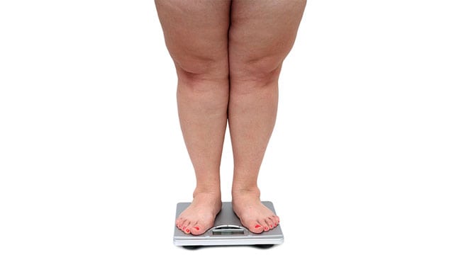 Weight-Loss-Surgery-What-is-Bariatric-Surgery-1-1